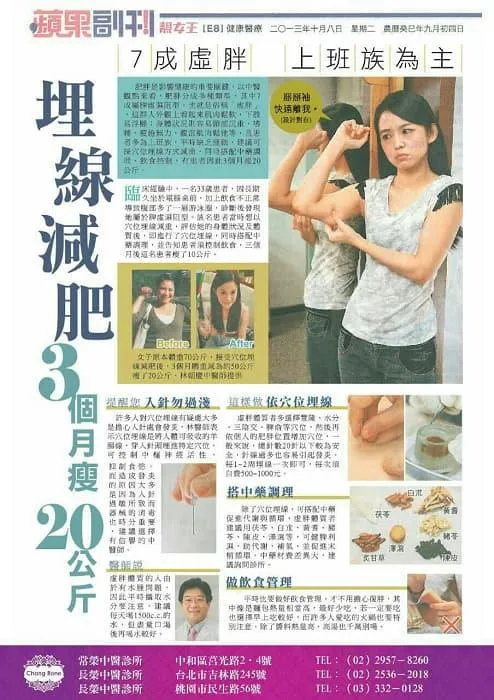 蘋果日報介紹中醫減重與埋線減肥效果